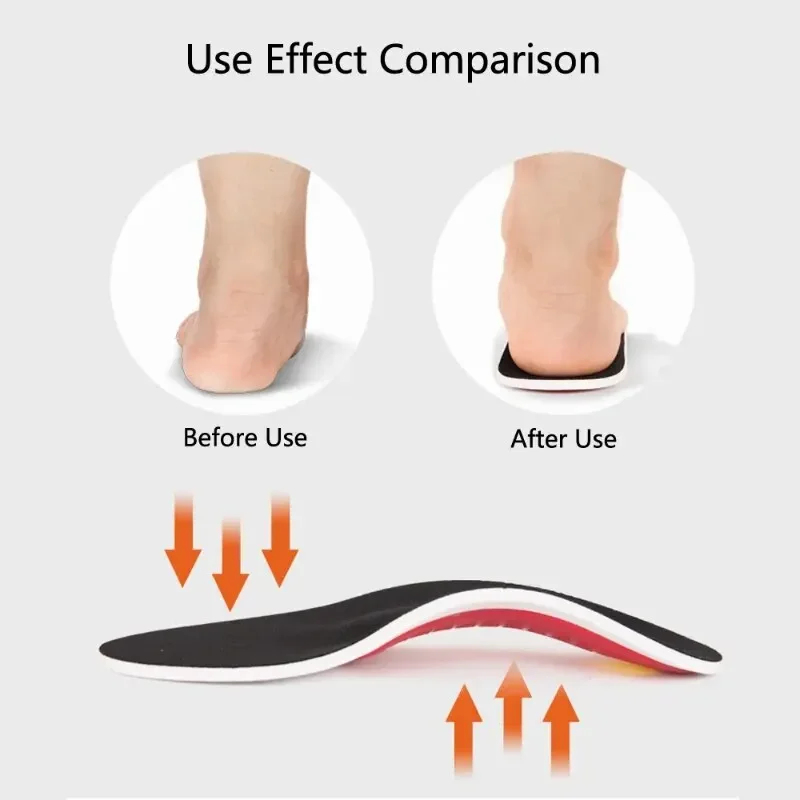 EVA 정형외과용 신발 깔창 남성용 평발 아치 지지대, - Men'S Shoes Plantar Fasciitis 리뷰 및 가격